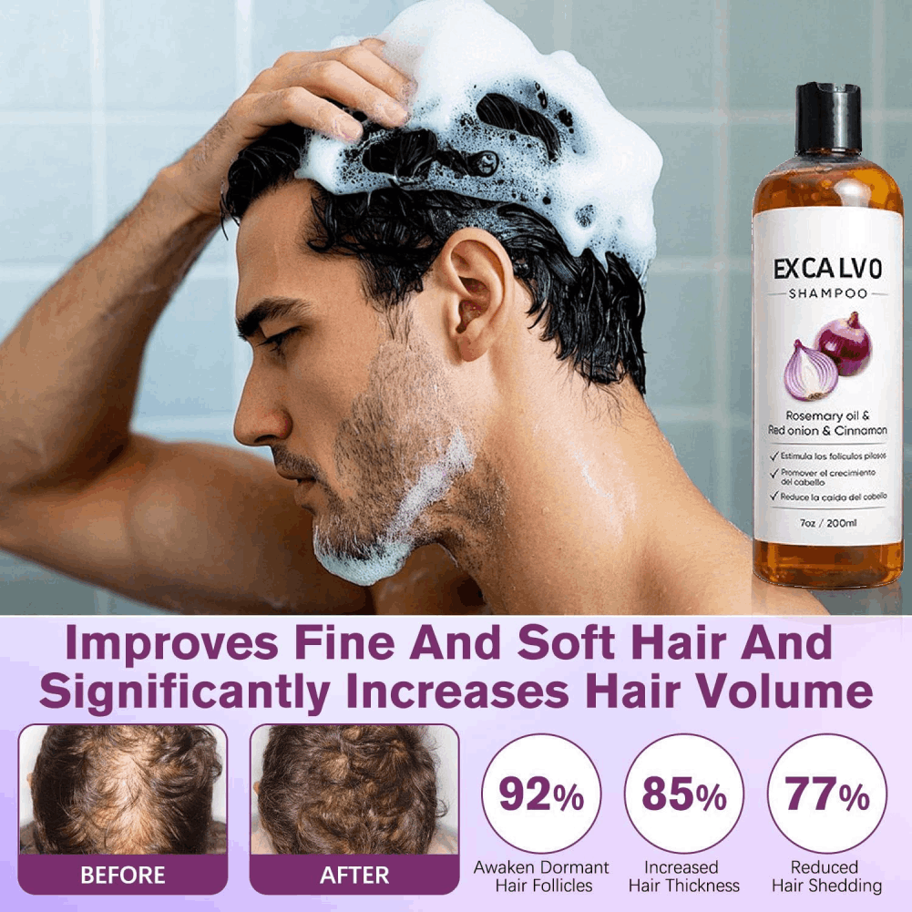 200ml ローズマリー＆レッドオニオン 育毛シャンプー デ - Rosemary Hair Oil のレビューと価格