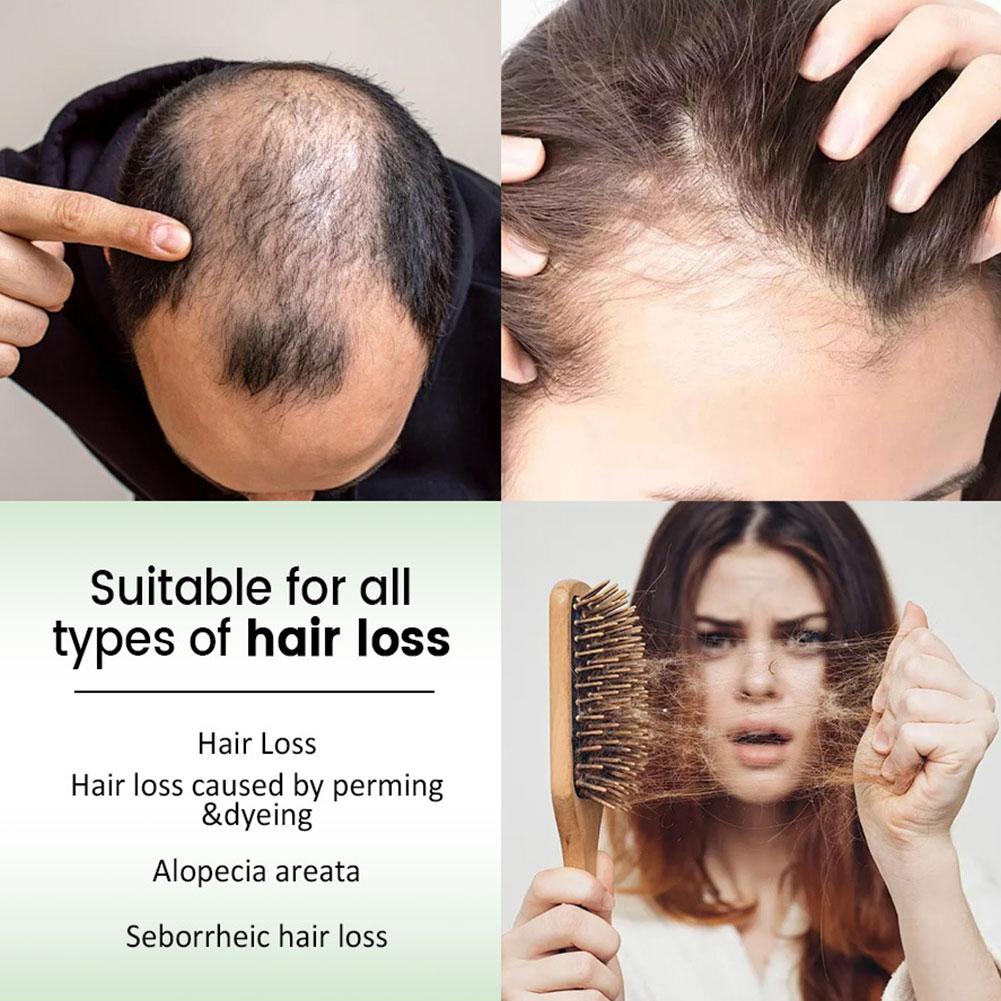 1/2 個ローズマリーヘアシャンプー ボリュームアップと増毛 - Rosemary Hair Oil のレビューと価格