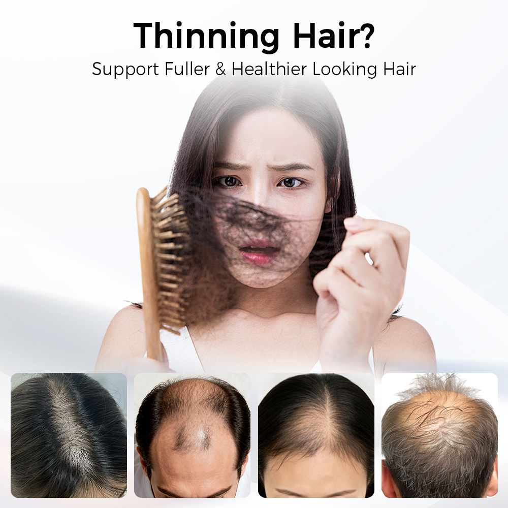 LED育毛キャップ 赤青光線療法帽子 630nm 470nm - Hair Care Basic のレビューと価格